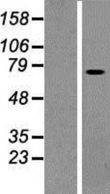 Western Blot: PLS1 Overexpression Lysate [NBP2-09739]