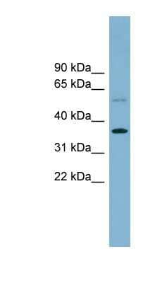 Western Blot: PLSCR3 Antibody [NBP1-52866]