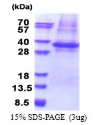 SDS-PAGE: Recombinant Human PLSCR3 His Protein [NBP2-23330]