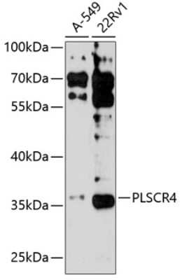 Western Blot: PLSCR4 AntibodyAzide and BSA Free [NBP2-93252]