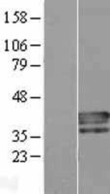 Western Blot: PLSCR4 Overexpression Lysate [NBL1-14527]