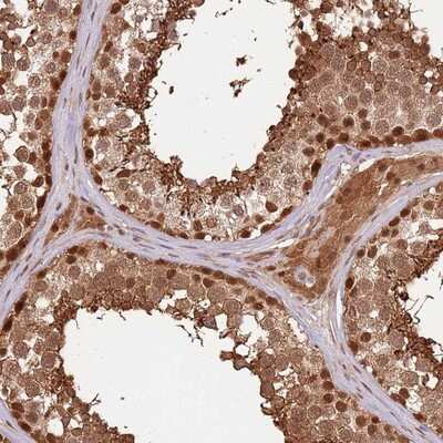 Immunohistochemistry-Paraffin: PLSCR5 Antibody [NBP2-14589]