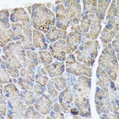 Immunohistochemistry-Paraffin: PLTP Antibody (6A1Q1) [NBP3-16847]