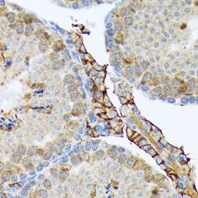 Immunohistochemistry-Paraffin: PLTP Antibody (6A1Q1) [NBP3-16847]