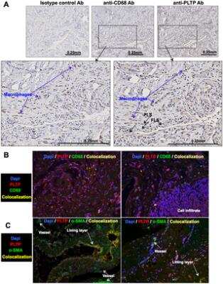 Immunohistochemistry: PLTP Antibody [NB400-106]