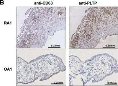 Immunohistochemistry: PLTP Antibody [NB400-106]