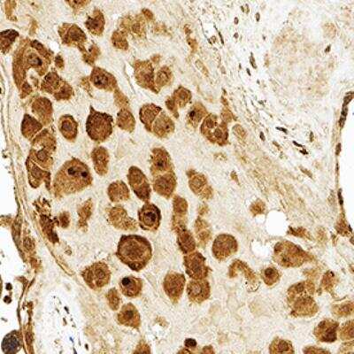 Immunohistochemistry-Paraffin: PLTP Antibody [NB400-106]