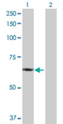 Western Blot: PLTP Antibody [H00005360-D01P]