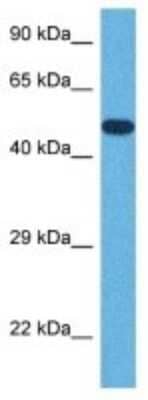 Western Blot: PLTP Antibody [NBP3-10028]