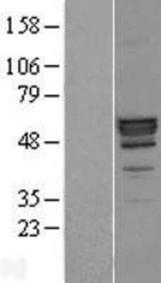 Western Blot: PLTP Overexpression Lysate [NBP2-04830]