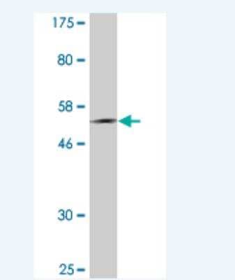 Western Blot: PLUNC Antibody (3C1) [H00051297-M05]