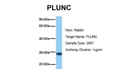 Western Blot: PLUNC Antibody [NBP1-58979]