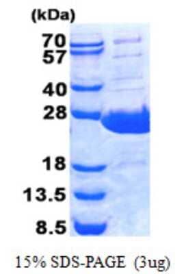 SDS-PAGE: Recombinant Human PLUNC His Protein [NBP2-22716]