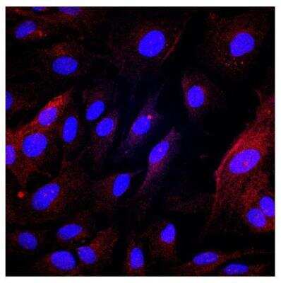 Immunocytochemistry/ Immunofluorescence: PLVAP Antibody [NBP2-19868]