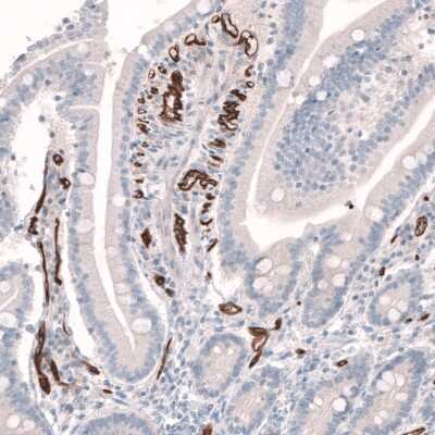 Immunohistochemistry-Paraffin: PLVAP Antibody [NBP1-83911]
