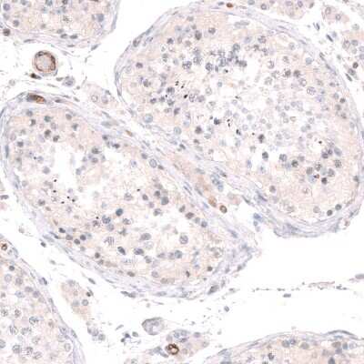 Immunohistochemistry-Paraffin: PLVAP Antibody [NBP1-83911]