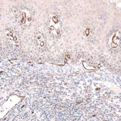 Immunohistochemistry-Paraffin: PLVAP Antibody [NBP1-83911]
