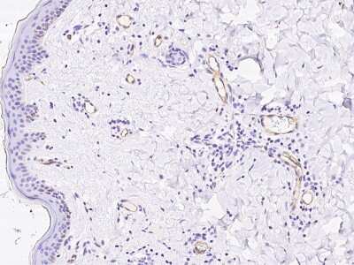 Immunohistochemistry-Paraffin: PLVAP Antibody [NBP2-97278]