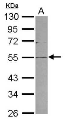 Western Blot: PLVAP Antibody [NBP2-19868]