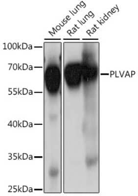 Western Blot: PLVAP AntibodyAzide and BSA Free [NBP2-94371]