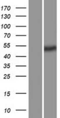 Western Blot: PLVAP Overexpression Lysate [NBP2-06137]