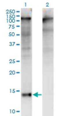 Western Blot: PLZF Antibody (3A7) [H00007704-M01]