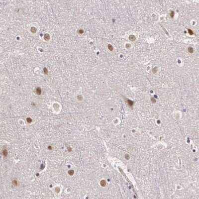 Immunohistochemistry-Paraffin: PLZF Antibody [NBP1-80894]