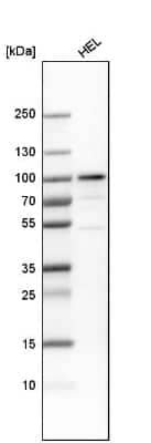 Western Blot: PLZF Antibody [NBP1-80894]