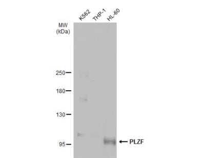 Western Blot: PLZF Antibody [NBP2-19870]