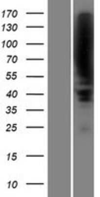 Western Blot: PLZF Overexpression Lysate [NBP2-10434]