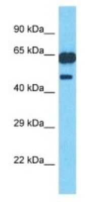 Western Blot: PM20D1 Antibody [NBP3-09876]