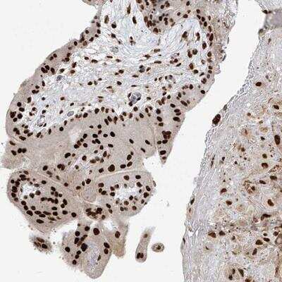 Immunohistochemistry-Paraffin: PM20D2 Antibody [NBP1-89259]