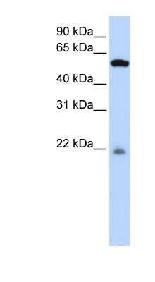 Western Blot: PM20D2 Antibody [NBP1-70678]