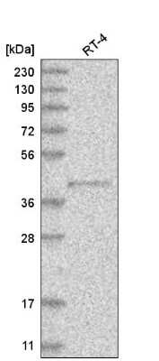 Western Blot: PM20D2 Antibody [NBP2-56435]