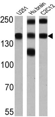 Western Blot: PMCA1 Antibody (5F10) [NB300-578]