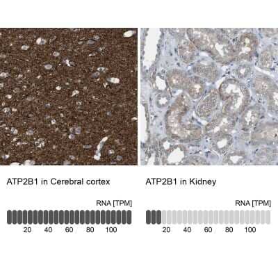 Immunohistochemistry-Paraffin: PMCA1 Antibody [NBP1-87260]