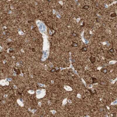 Immunohistochemistry-Paraffin: PMCA1 Antibody [NBP1-87261]