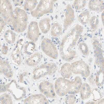 Immunohistochemistry-Paraffin: PMCA1 Antibody [NBP1-87261]