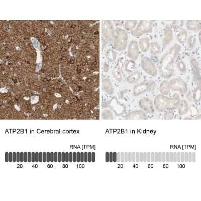 Immunohistochemistry-Paraffin: PMCA1 Antibody [NBP1-87261]