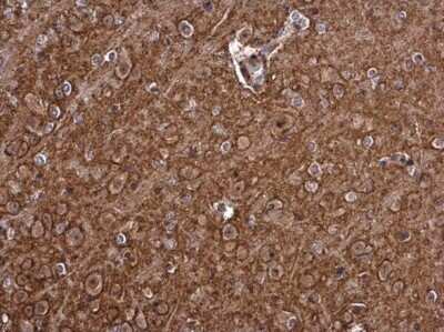 Immunohistochemistry-Paraffin: PMCA1 Antibody [NBP3-12964]