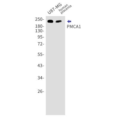 Western Blot: PMCA1 Antibody (S02-8C5) [NBP3-19742]