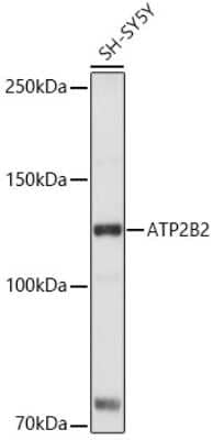 Western Blot: PMCA2 AntibodyAzide and BSA Free [NBP2-95221]