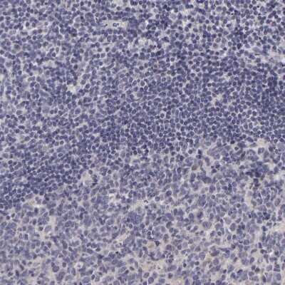 Immunohistochemistry-Paraffin: PMCA3 Antibody [NBP1-87259]