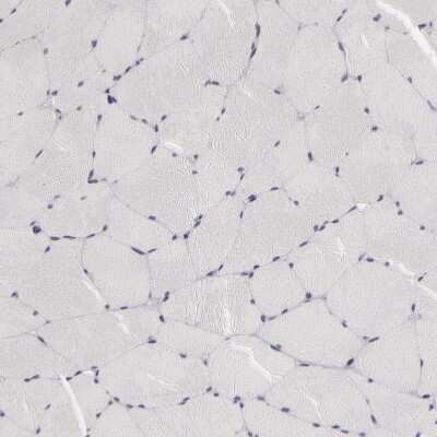 Immunohistochemistry-Paraffin: PMCA3 Antibody [NBP1-87259]