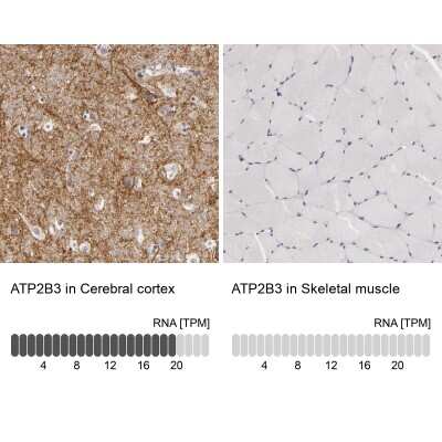 Immunohistochemistry-Paraffin: PMCA3 Antibody [NBP1-87259]