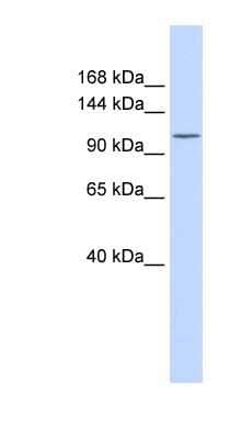 Western Blot: PMCA3 Antibody [NBP1-59426]