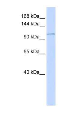 Western Blot: PMCA3 Antibody [NBP1-59465]