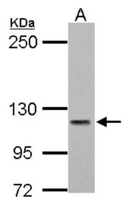 Western Blot: PMCA3 Antibody [NBP2-19871]