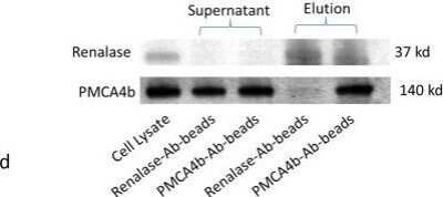 Western Blot: PMCA4 Antibody (2G8) [H00000493-M07]