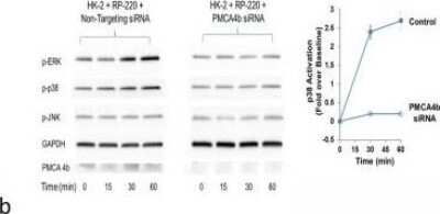 Western Blot: PMCA4 Antibody (2G8) [H00000493-M07]